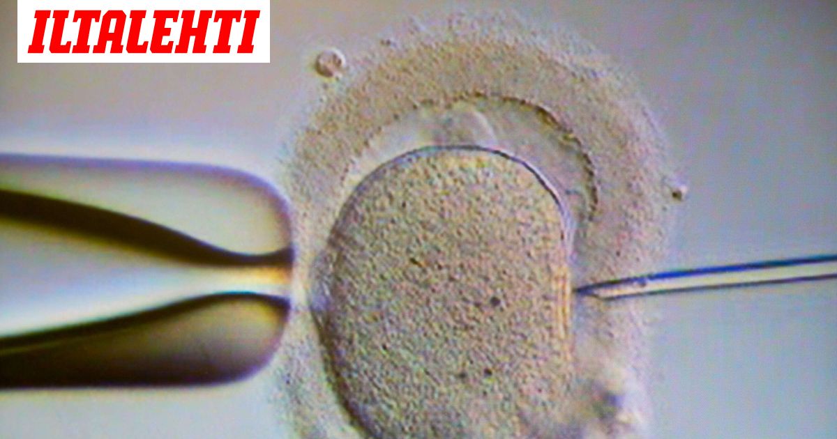Syöpäsperma levisi ympäri Eurooppaa – 10 lasta sairastui Syöpäsperma levisi ympäri Eurooppaa – 10 lasta sairastui